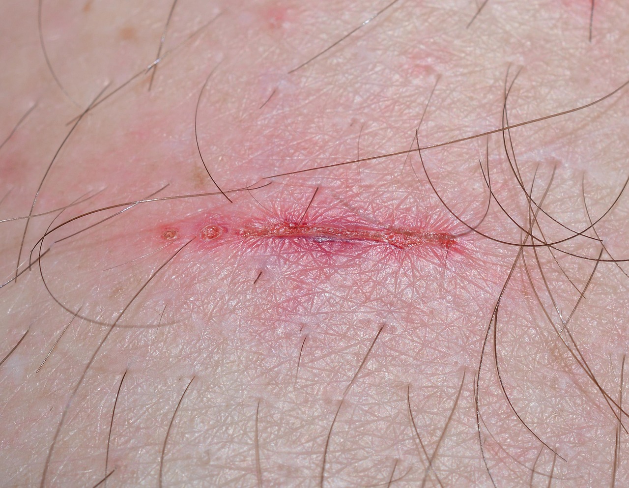wound, injury, time heals all wounds, place of miracles, consolation, fresh, wound, wound, wound, wound, wound, injury