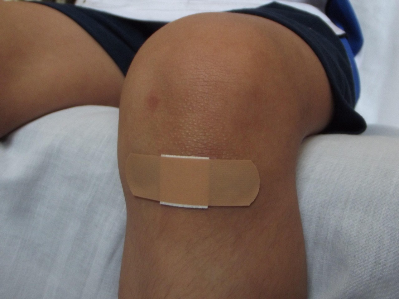 wound, wounds, wounded, injured, bandita, cure, baby, people, kid, kids, person, little girl, wound, wound, wound, wound, wound, injured